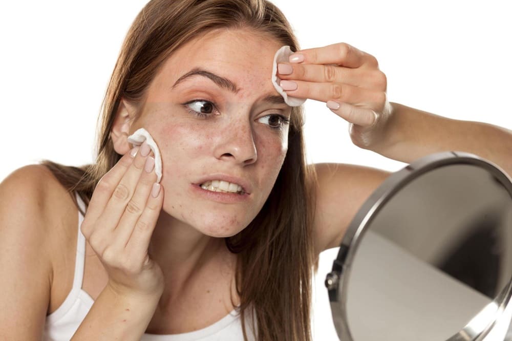 Les 10 erreurs les plus fréquentes en matière d'acné